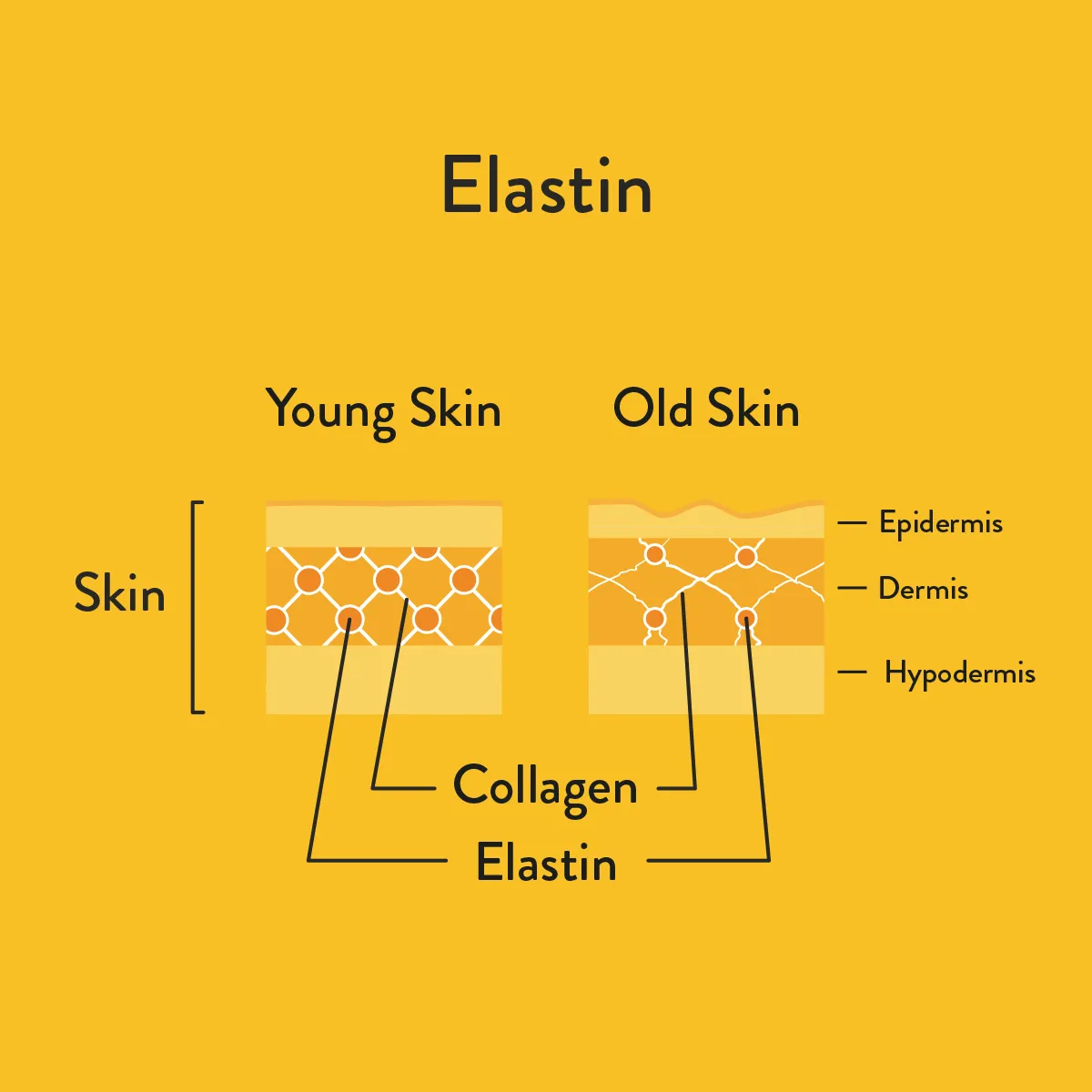 elastin  informative diagram