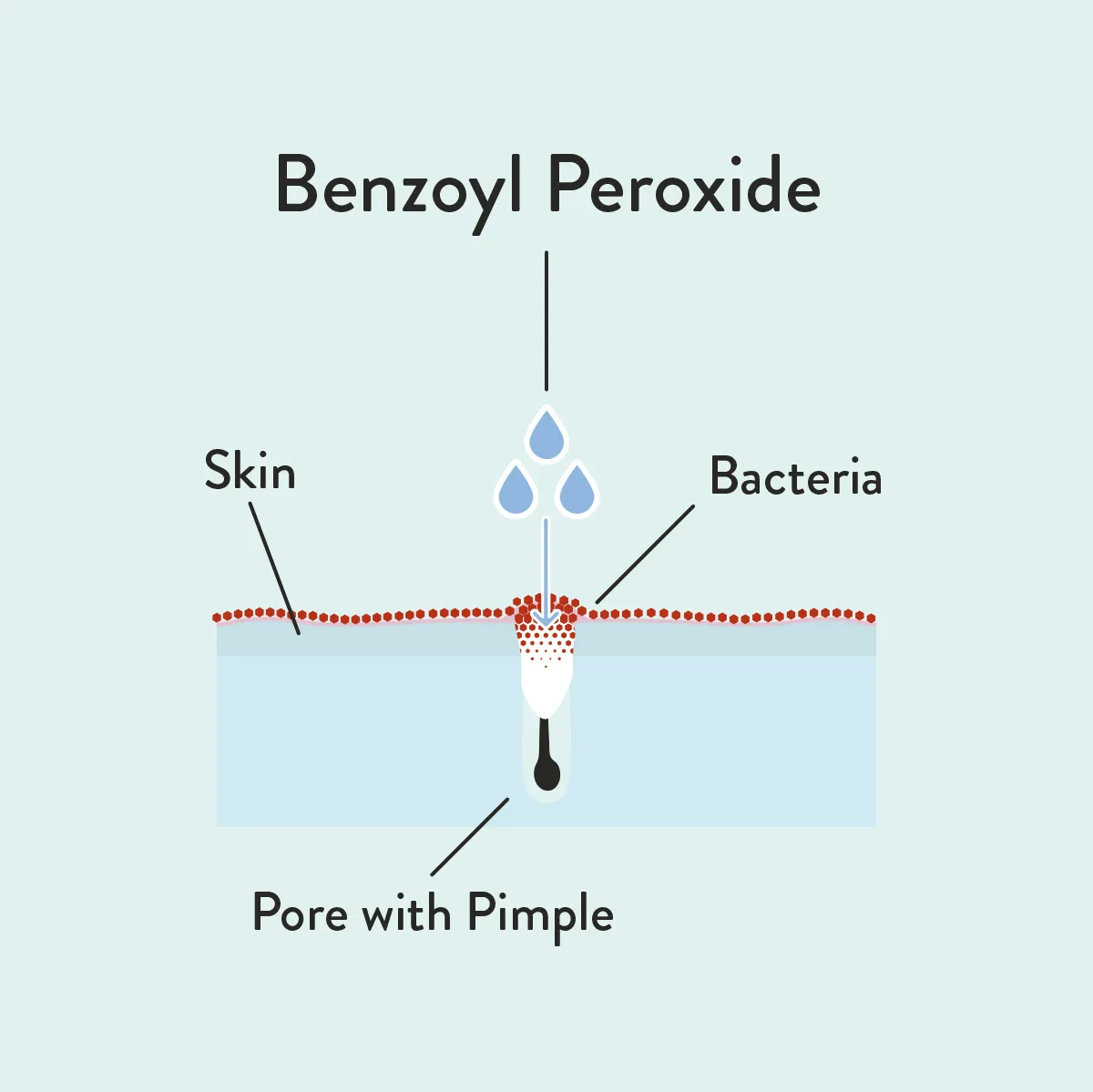 Benzoyl Peroxide (BPO) informative diagram