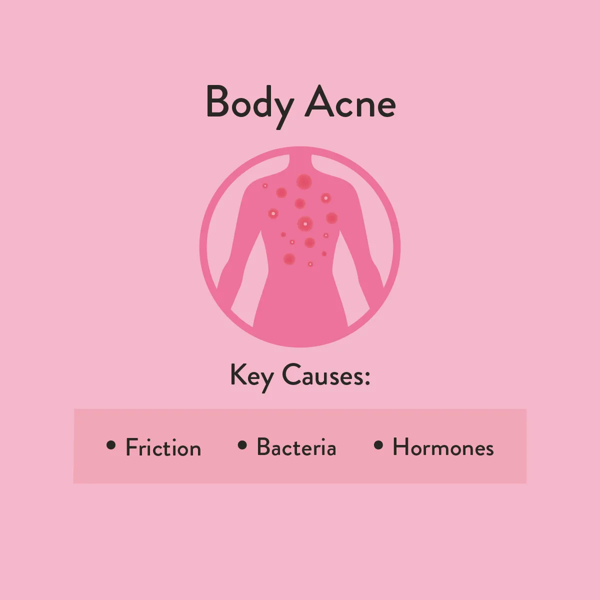 Body acne informative diagram