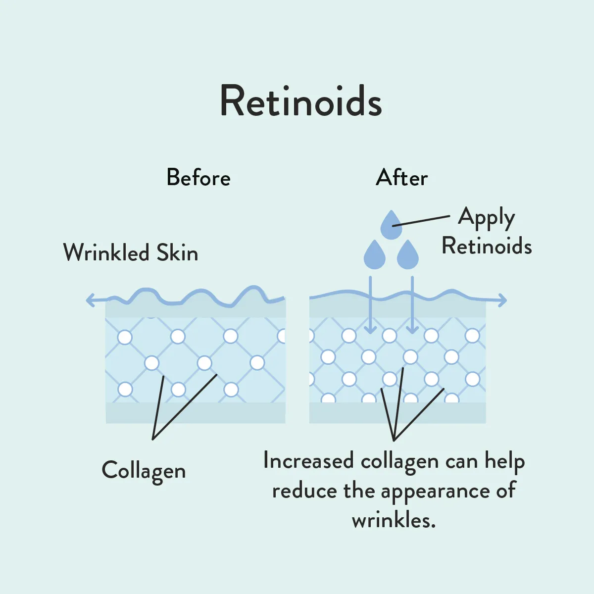 Retinoids informative diagram